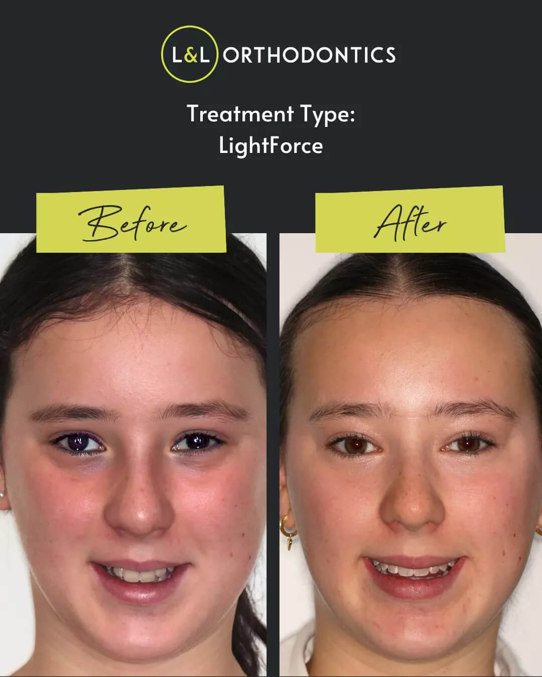 L&L Orthodontics - Instagram