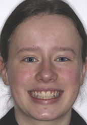 Patient After