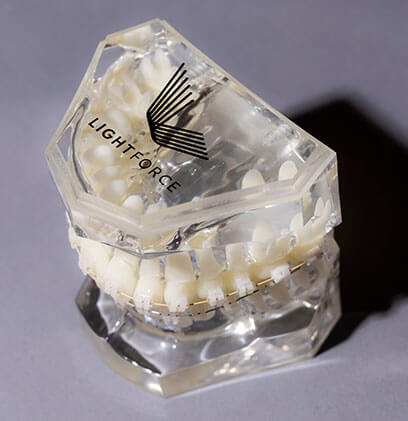 Smile blog