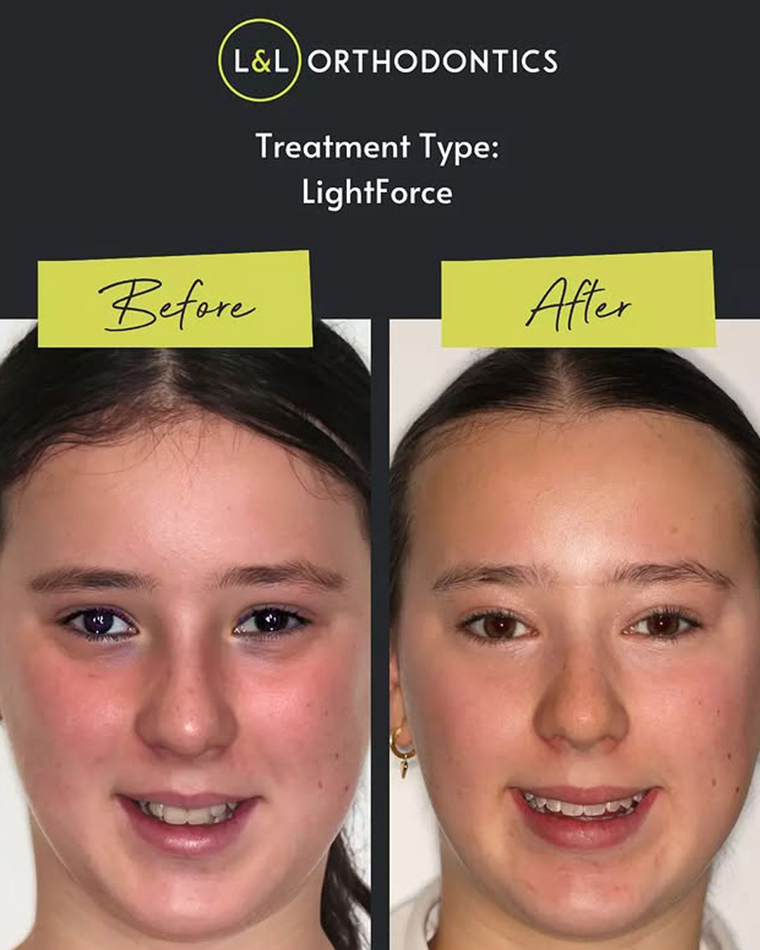 L&L Orthodontics - Instagram