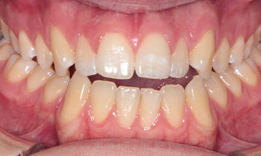 Before & Afters