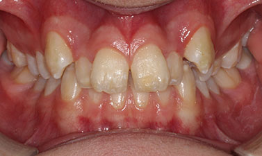 Before & Afters
