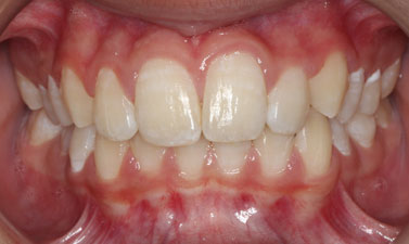 Before & Afters