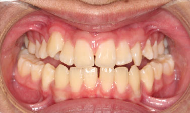 Before & Afters