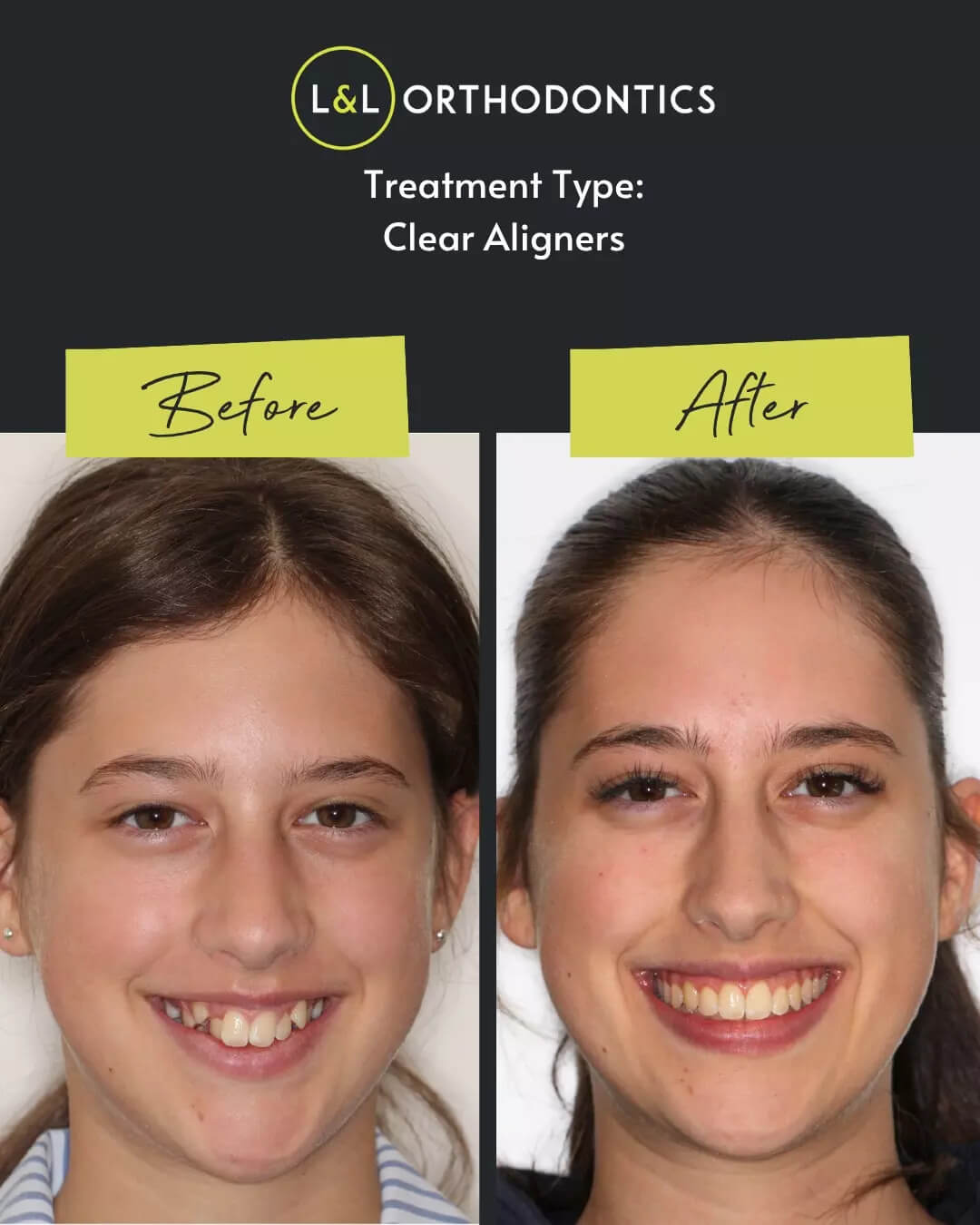 L&L Orthodontics - Instagram