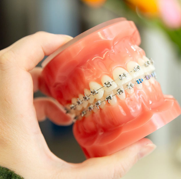 Are Metal braces right for me?