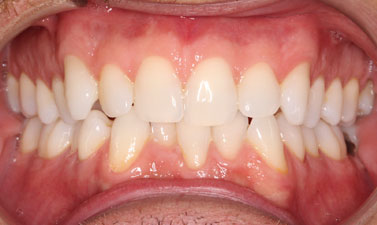 Before & Afters