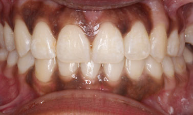 Before & Afters