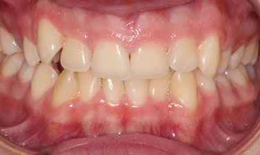 Before & Afters