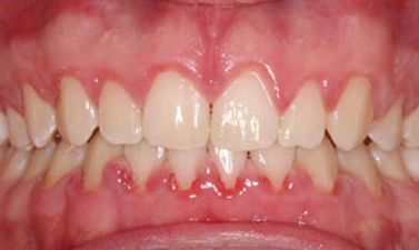 Before & Afters