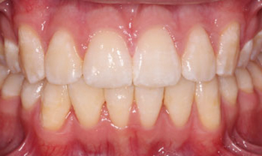 Before & Afters