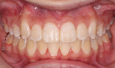 Before & Afters
