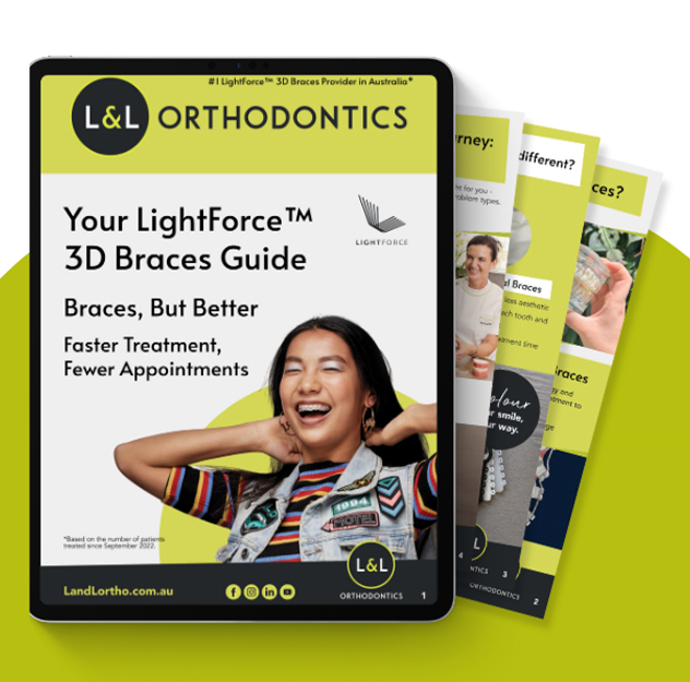 Discover the futureof Braces