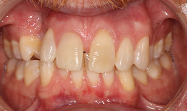 Before & Afters