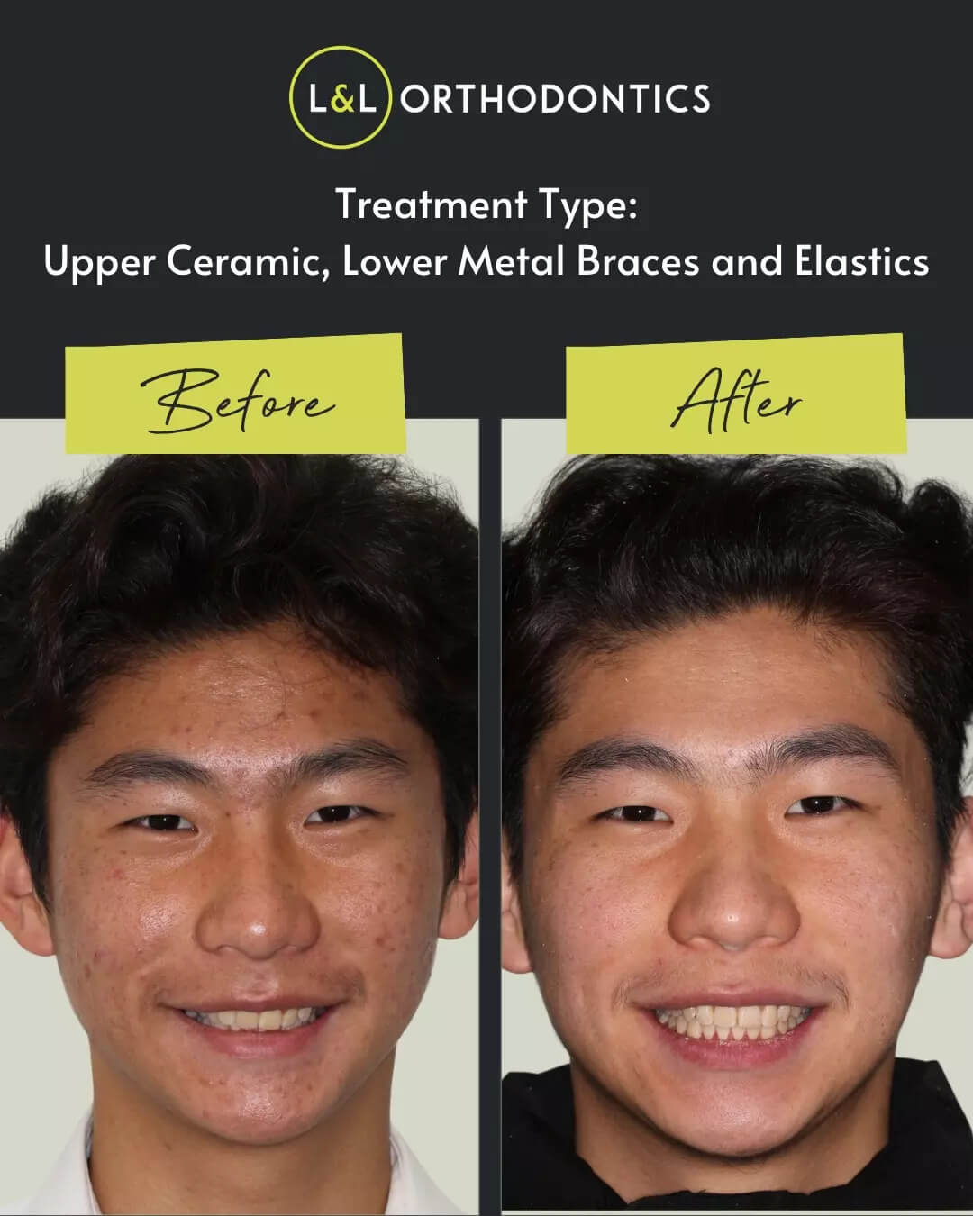 L&L Orthodontics - Instagram