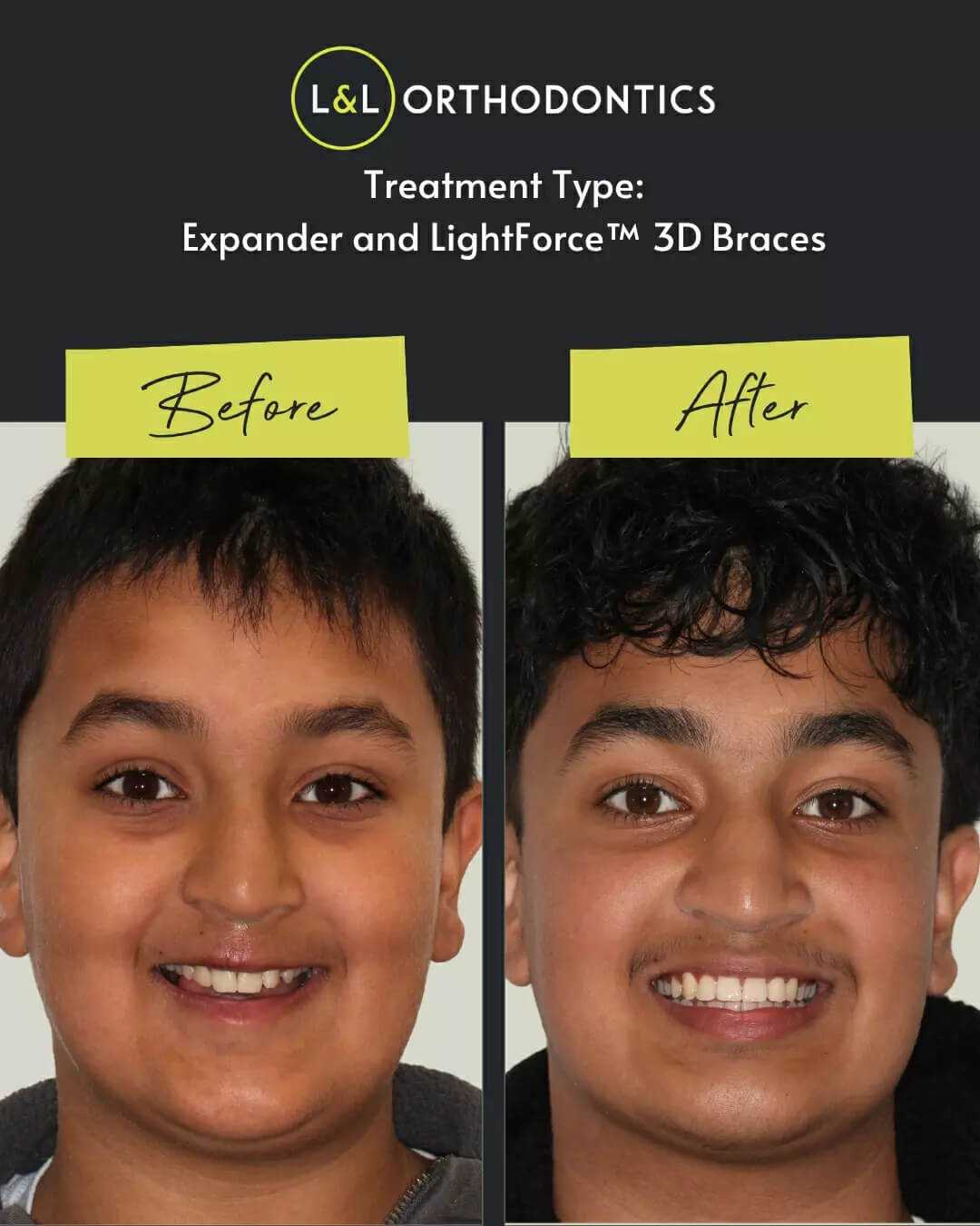L&L Orthodontics - Instagram