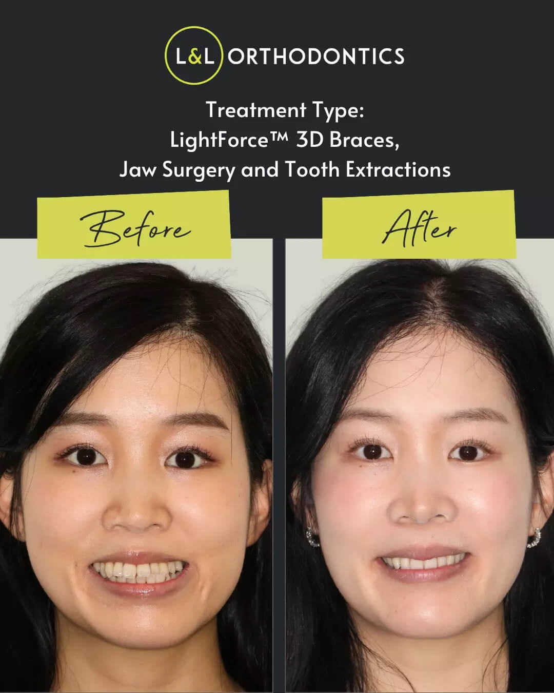 L&L Orthodontics - Instagram
