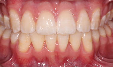 Before & Afters