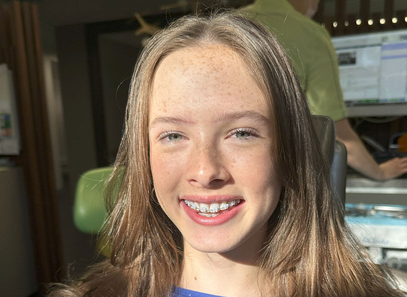 Orthodontic Treatment for Teens in Melbourne