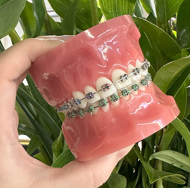 Are Metal braces right for me? Are Metal braces right for me?