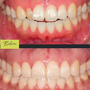 L&L Orthodontics - Instagram