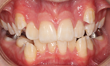 Before & Afters