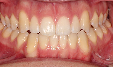 Before & Afters