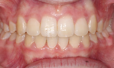 Before & Afters