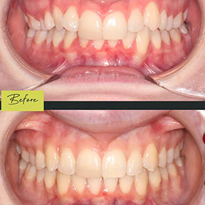 L&L Orthodontics - Instagram