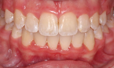 Before & Afters