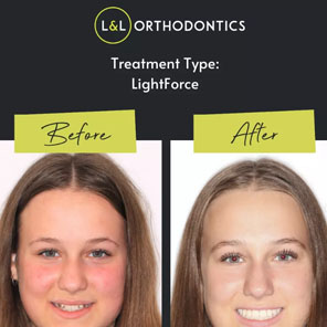 L&L Orthodontics - Instagram