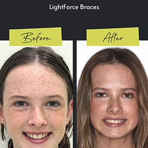 L&L Orthodontics - Instagram