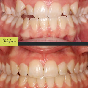 L&L Orthodontics - Instagram