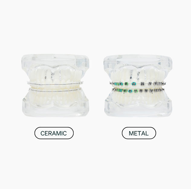 Introducing LightBracket Metal