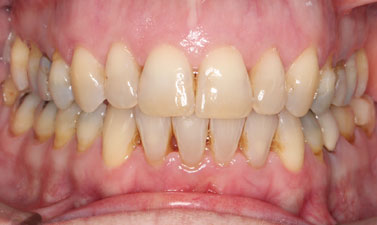 Before & Afters