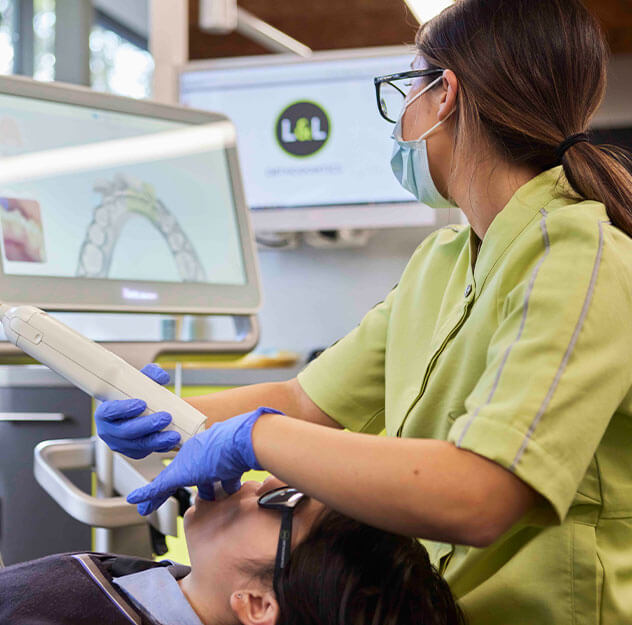How do Spark Aligners work How do Spark Aligners work
