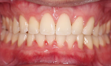 Before & Afters