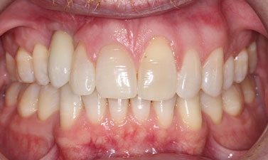 Before & Afters