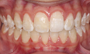 Before & Afters