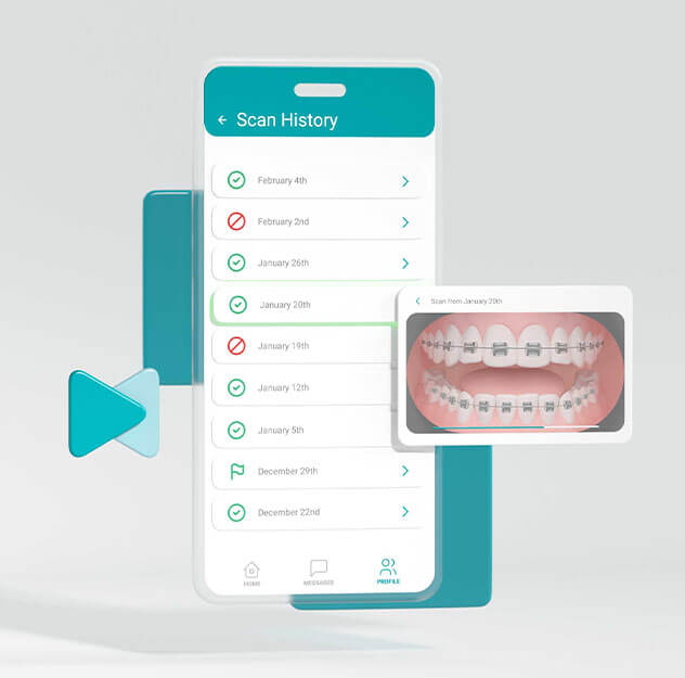 Dental Monitoring