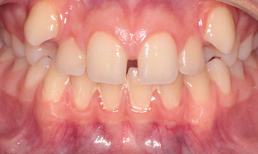 Before & Afters