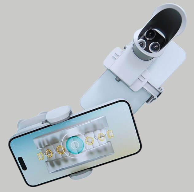 What is Dental Monitoring What is Dental Monitoring