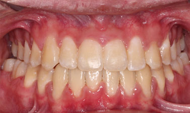 Before & Afters