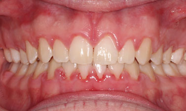 Before & Afters