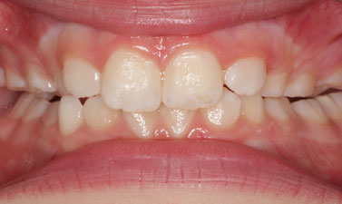 Before & Afters