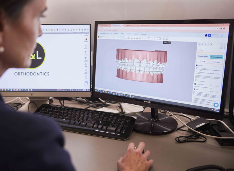 Transfer Your Orthodontic Treatment to LL Orthodontics