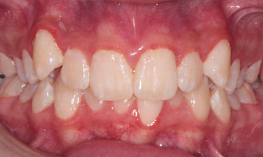 Before & Afters
