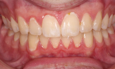 Before & Afters