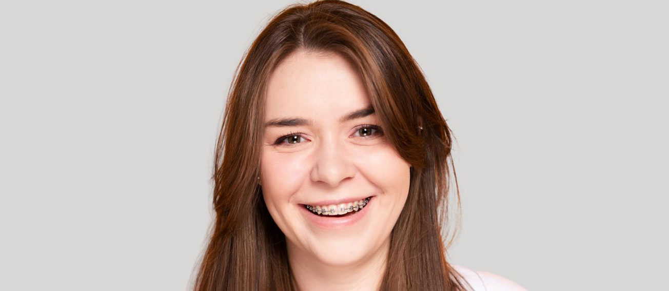 5 Common Braces Myths Busted: What You Really Need to Know
