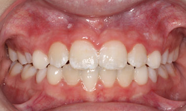 Before & Afters